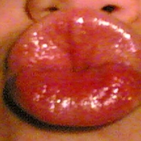 kiss